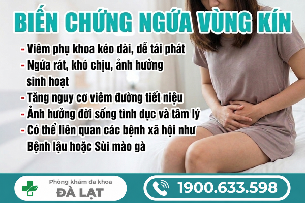 Hình ảnh minh họa